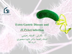 Extra Gastric Disease and H.Pylori infection