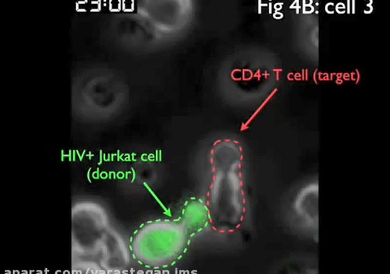 ویروس HIV اینگونه در بدن پخش می شود