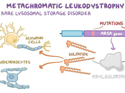 Metachromatic leukodystrophy