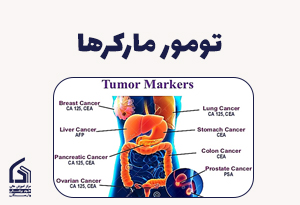 تومور