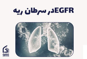 نقش EGFR در سرطان ریه
