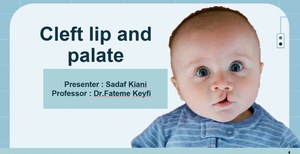 Cleft lip and palate