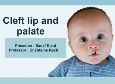 Cleft lip and palate